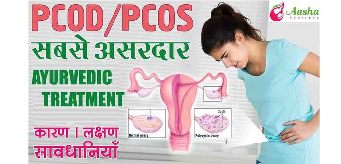 Best natural ways to treat PCOS | Story of a woman having PCOS | Aasha Ayurveda