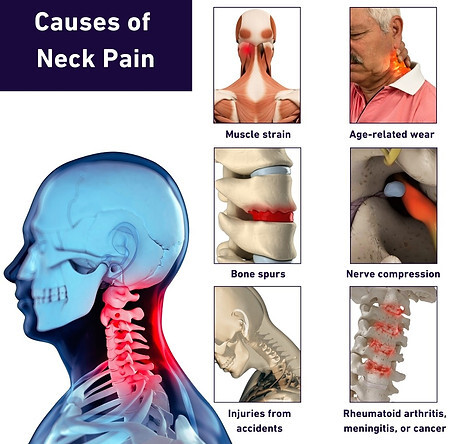Neck Pain Newport Beach, Chiropractic Treatments for Neck Pain